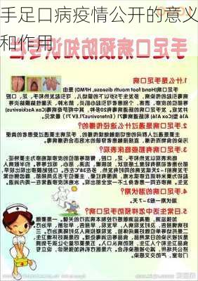 手足口病疫情公开的意义和作用
