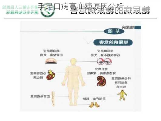 手足口病高血糖原因分析