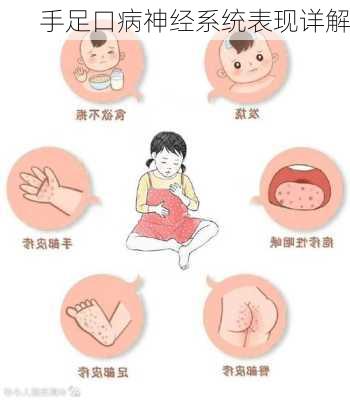 手足口病神经系统表现详解