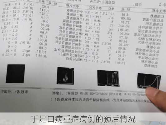 手足口病重症病例的预后情况