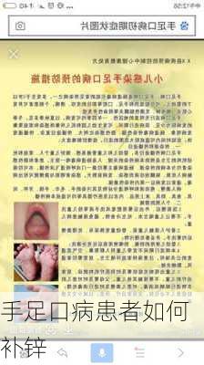 手足口病患者如何补锌