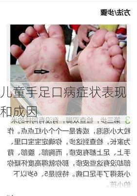 儿童手足口病症状表现和成因