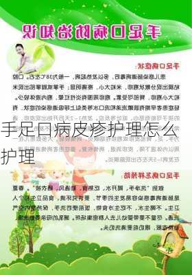 手足口病皮疹护理怎么护理