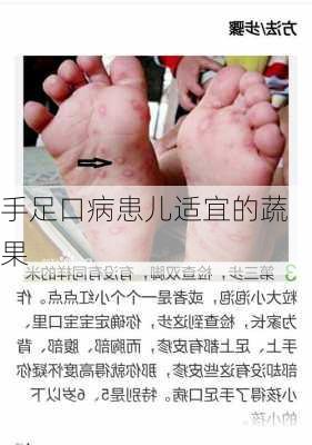 手足口病患儿适宜的蔬果