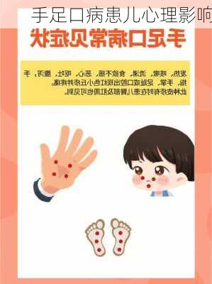 手足口病患儿心理影响