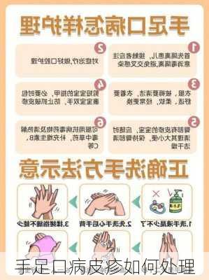手足口病皮疹如何处理