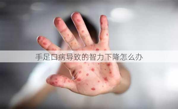 手足口病导致的智力下降怎么办