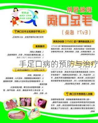 手足口病的预防与治疗