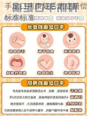 手足口病康复后遗症赔偿标准标准