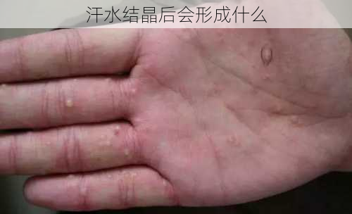 汗水结晶后会形成什么