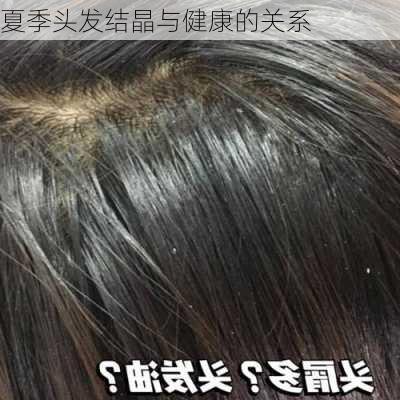 夏季头发结晶与健康的关系