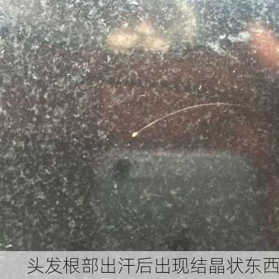 头发根部出汗后出现结晶状东西
