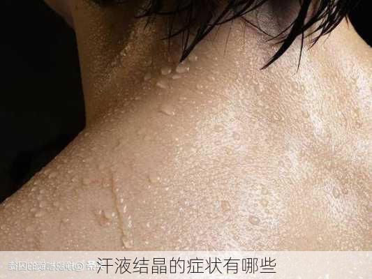 汗液结晶的症状有哪些