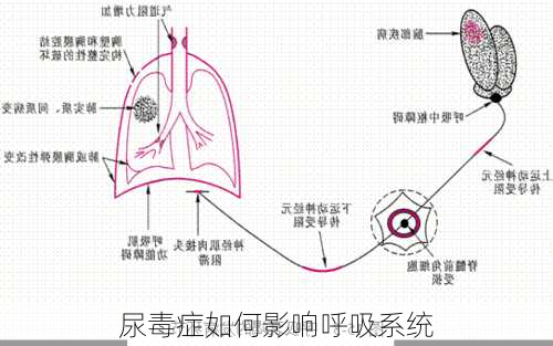 尿毒症如何影响呼吸系统