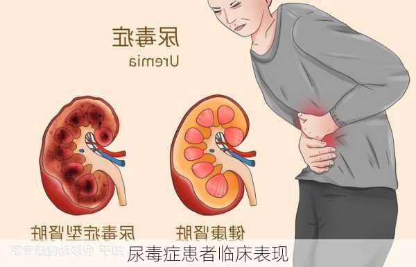 尿毒症患者临床表现