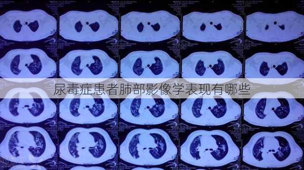 尿毒症患者肺部影像学表现有哪些