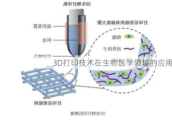 3D打印技术在生物医学领域的应用