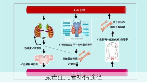 尿毒症患者补钙途径