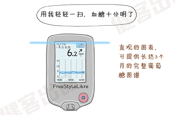 动态血糖监测设备的工作原理
