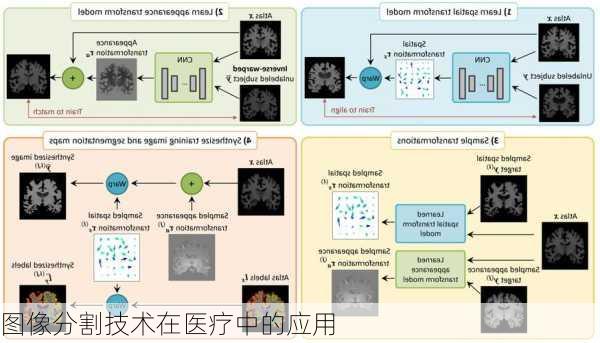 图像分割技术在医疗中的应用