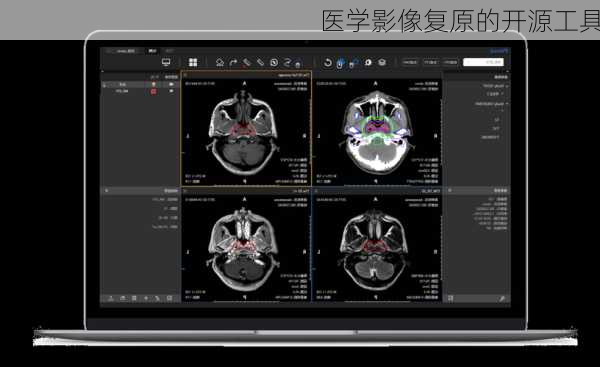 医学影像复原的开源工具