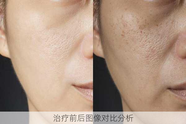 治疗前后图像对比分析