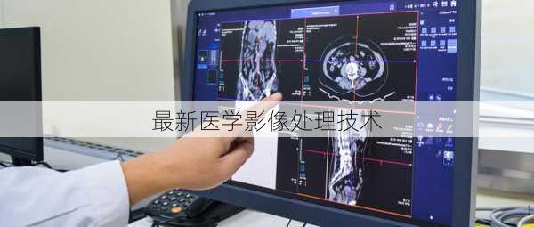 最新医学影像处理技术