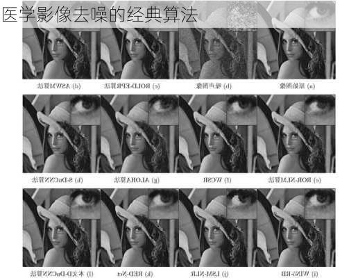 医学影像去噪的经典算法