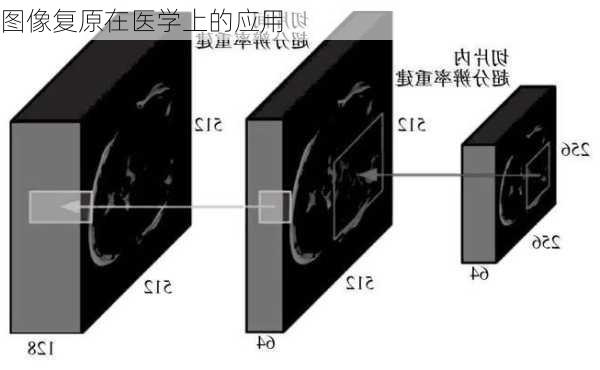图像复原在医学上的应用