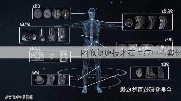图像复原技术在医疗中的案例