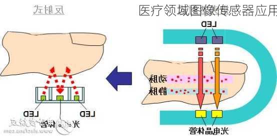医疗领域图像传感器应用