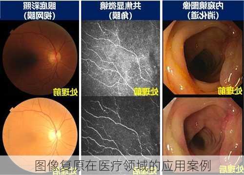 图像复原在医疗领域的应用案例