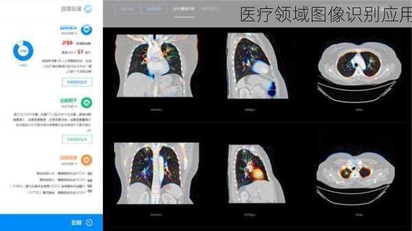 医疗领域图像识别应用