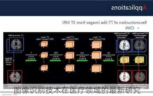 图像识别技术在医疗领域的最新研究