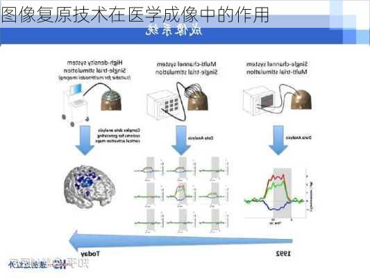 图像复原技术在医学成像中的作用
