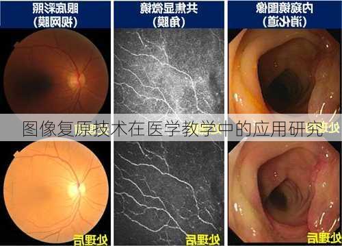 图像复原技术在医学教学中的应用研究
