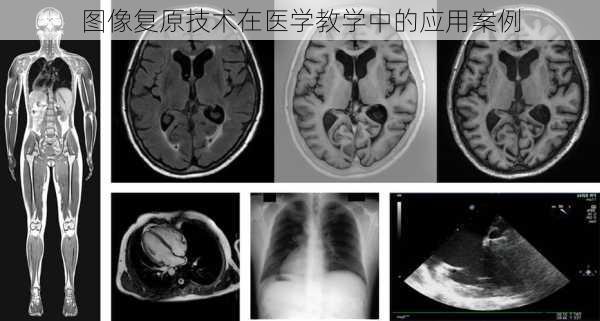 图像复原技术在医学教学中的应用案例