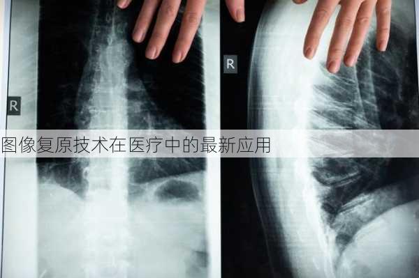 图像复原技术在医疗中的最新应用