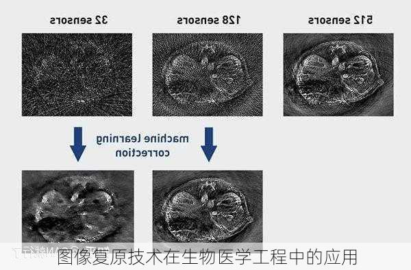图像复原技术在生物医学工程中的应用
