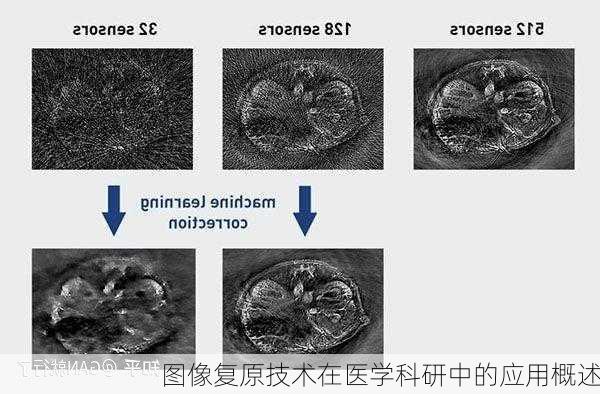 图像复原技术在医学科研中的应用概述