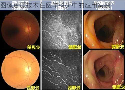 图像复原技术在医学科研中的应用案例