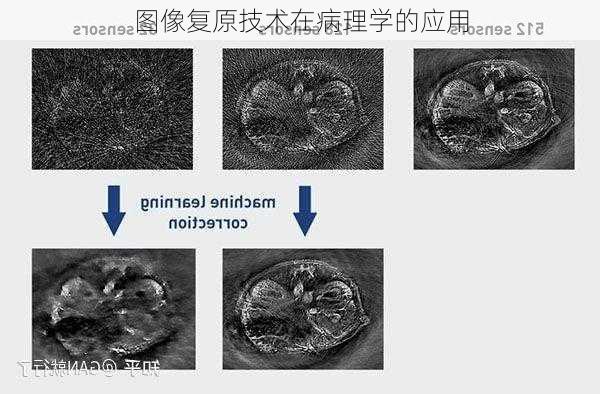 图像复原技术在病理学的应用