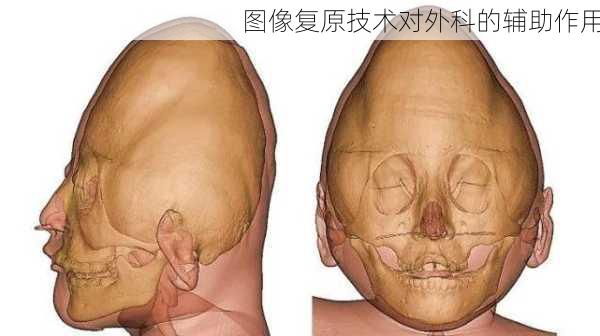 图像复原技术对外科的辅助作用