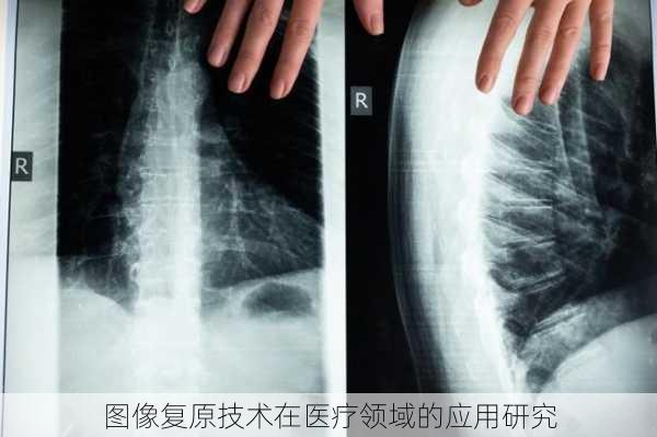 图像复原技术在医疗领域的应用研究