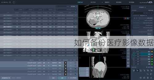 如何备份医疗影像数据