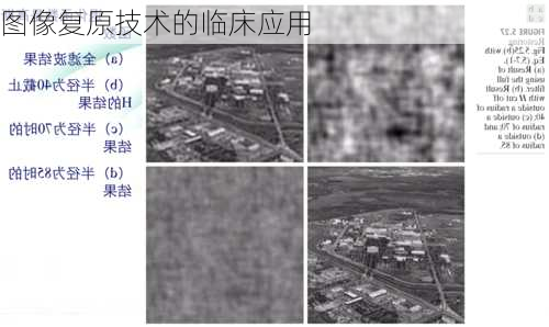 图像复原技术的临床应用