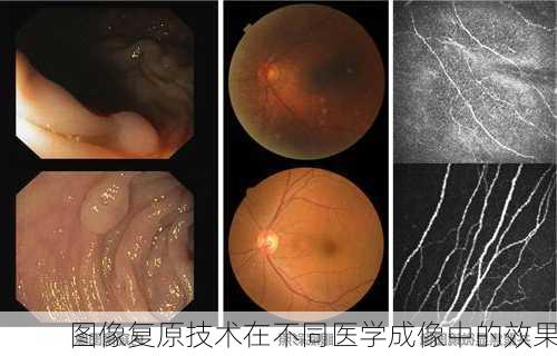 图像复原技术在不同医学成像中的效果