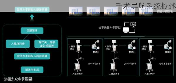 手术导航系统概述