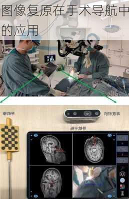 图像复原在手术导航中的应用