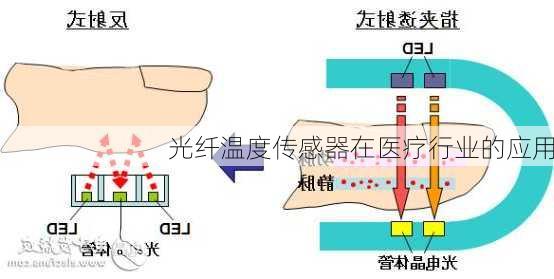 光纤温度传感器在医疗行业的应用